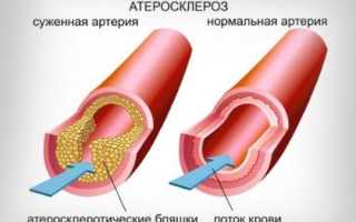 Что вреднее кушать Доширак или Роллтон
