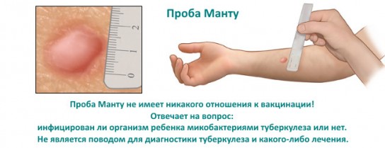 Уход за прививкой