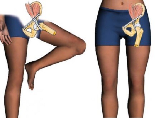 Основные болезни