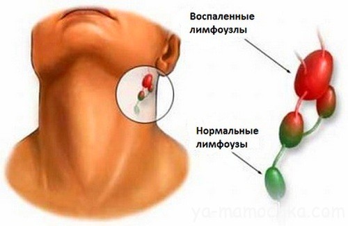 Как распознать болезнь?