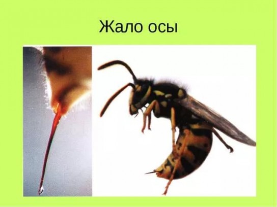 Что делать если укусила оса?