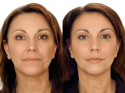 Маски для лица