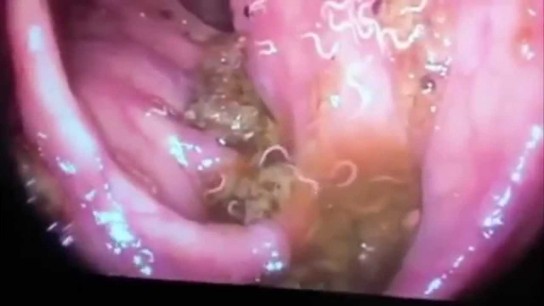 Ухудшение состояния