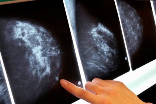 Процесс УЗИ молочной железы?